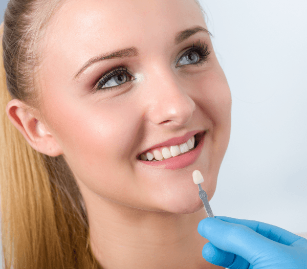 Dental Veneers in Woodley